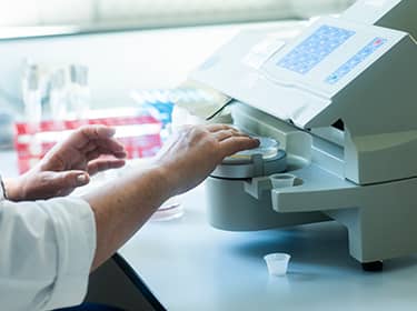 De foto toont een apparaat voor diagnose van infectieziekten