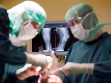 De foto toont twee chirurgen die een knie opereren