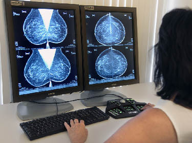 De foto toont iemand achter twee computerschermen waarop een mammografie te zien is