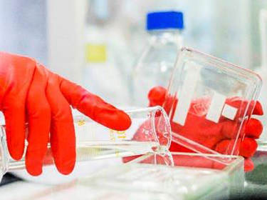 De foto toont de handen van een onderzoeker in een laboratorium