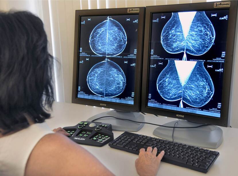 We kijken op de foto mee over de schouder van een vrouw die aan een bureau zit en twee toetsenborden bedient en hebben zicht op twee beeldschermen met daarop röntgenfoto's van borstonderzoek.